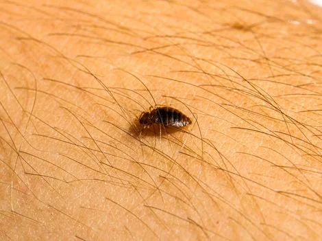 After Treatment - Bed Bug Treatment Surrey